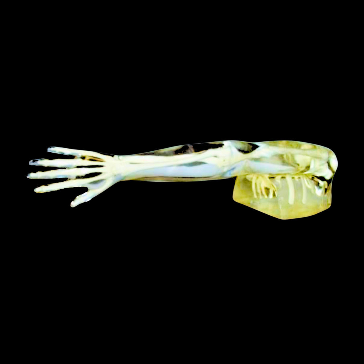 Phantom: Transparent arm and shoulder,, Right only — MTM - Médical Tronik
