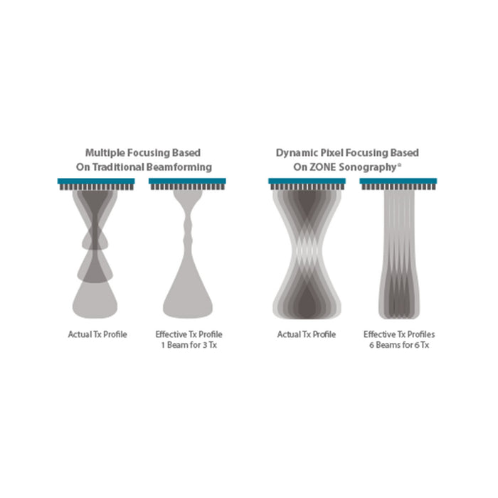 Vetus E7 - Hand-Carried Veterinary Ultrasound System