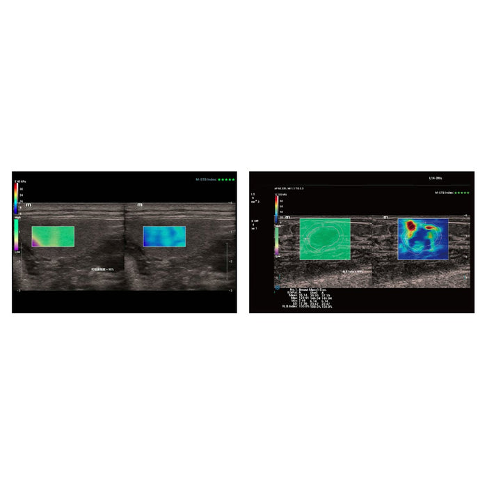 Mindray Vetus 9, Premium Veterinary Ultrasound System