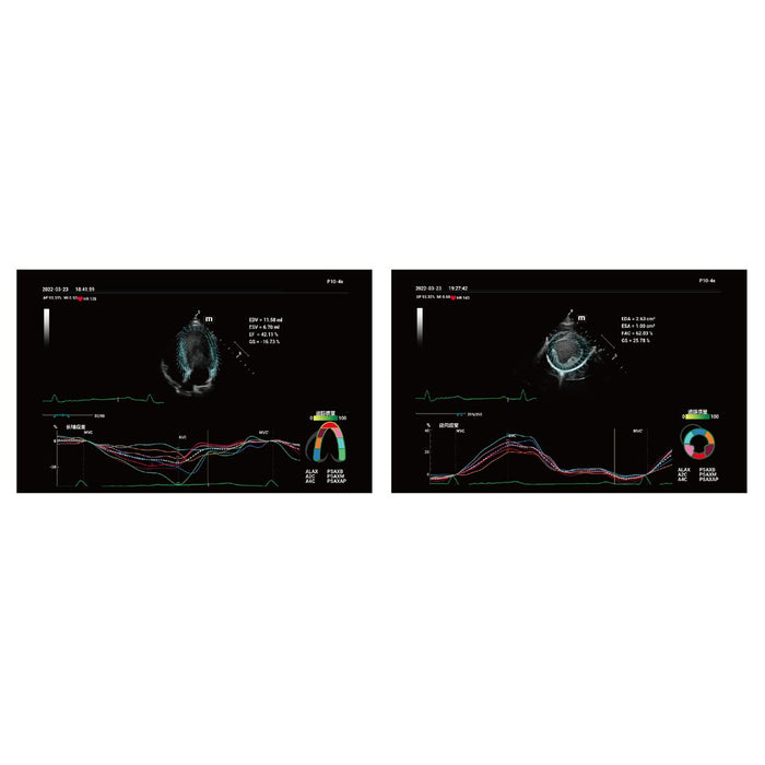 Mindray Vetus 9, Premium Veterinary Ultrasound System