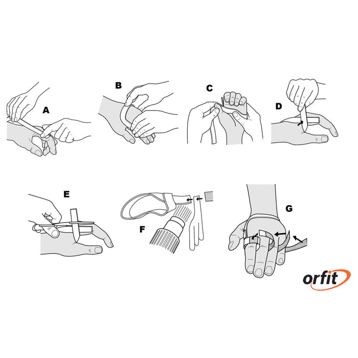Orfit Shell Orfit Classic non perforated ulnar drift orthosis 3.2 mm — MTM ...