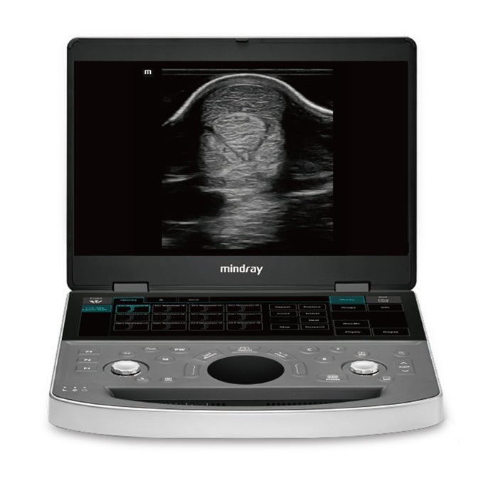 Mindray Vetus EQ, Hand-Carried Equine Ultrasound System