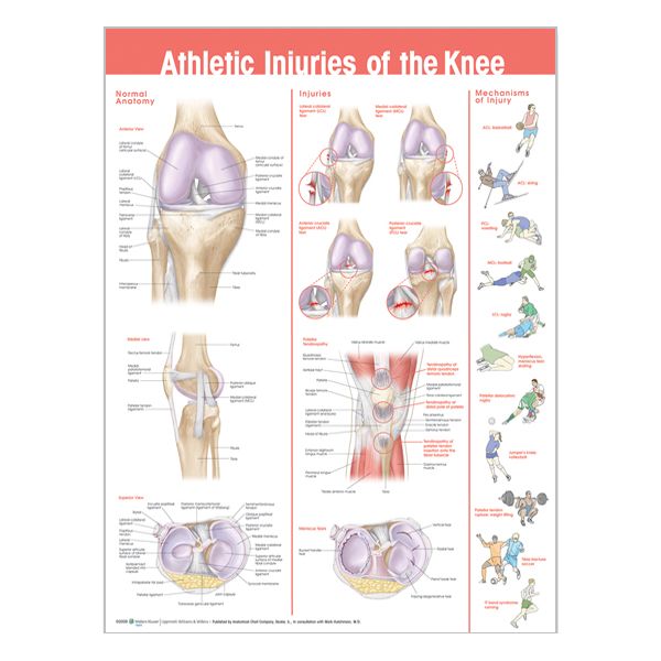 Chart "Athletic injuries of the knee"