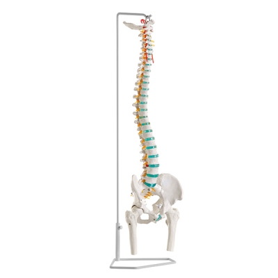 Economic vertebral column with femur heads