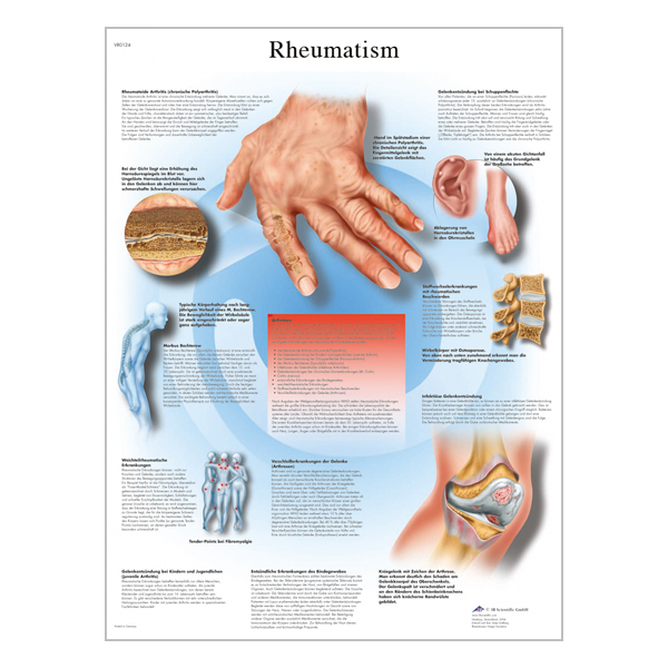 Charte "Rheumatis"