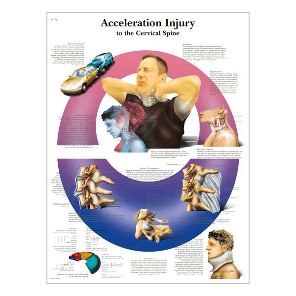 Charte « Acceleration Injury to the Cervical Spine »