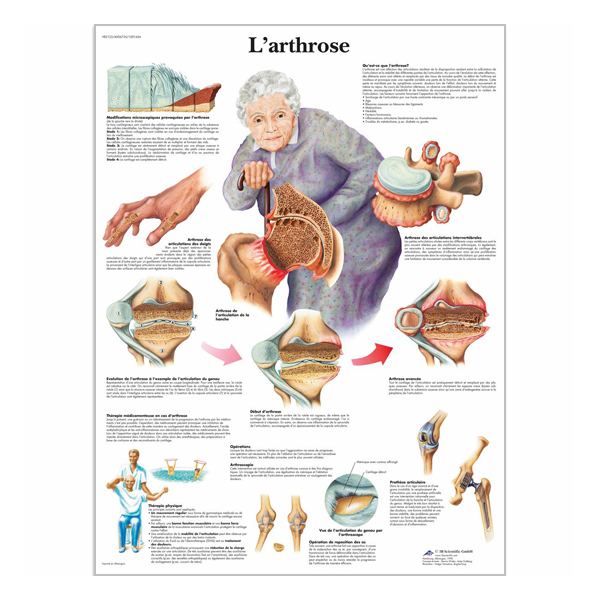 Charte "L'arthrose"