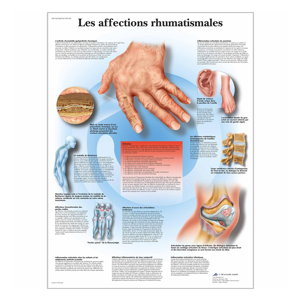Charte "Les affections Rhumatimales"