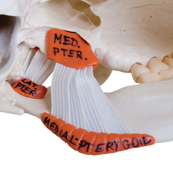 TMJ Human Skull Model, 2 parts