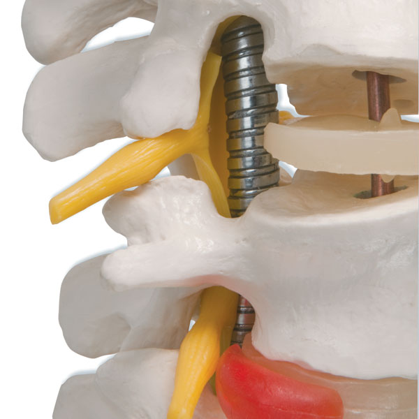 Deluxe Vertebral Male Column with Femoral Heads and Support