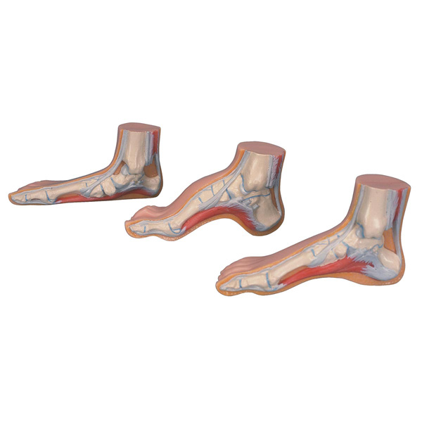 Functional MEDart Foot Series models