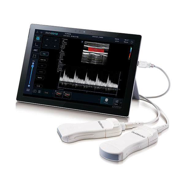 Tablet-based ultrasound system minisono